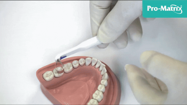 Pro-Matrix® Application Demonstration