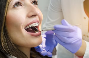 braces_clinician_2-1