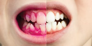 disclosing_comparison_1000x500