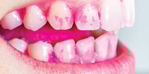 disclosing_solution_trace_1000x500