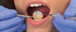 oral-dryness-blog